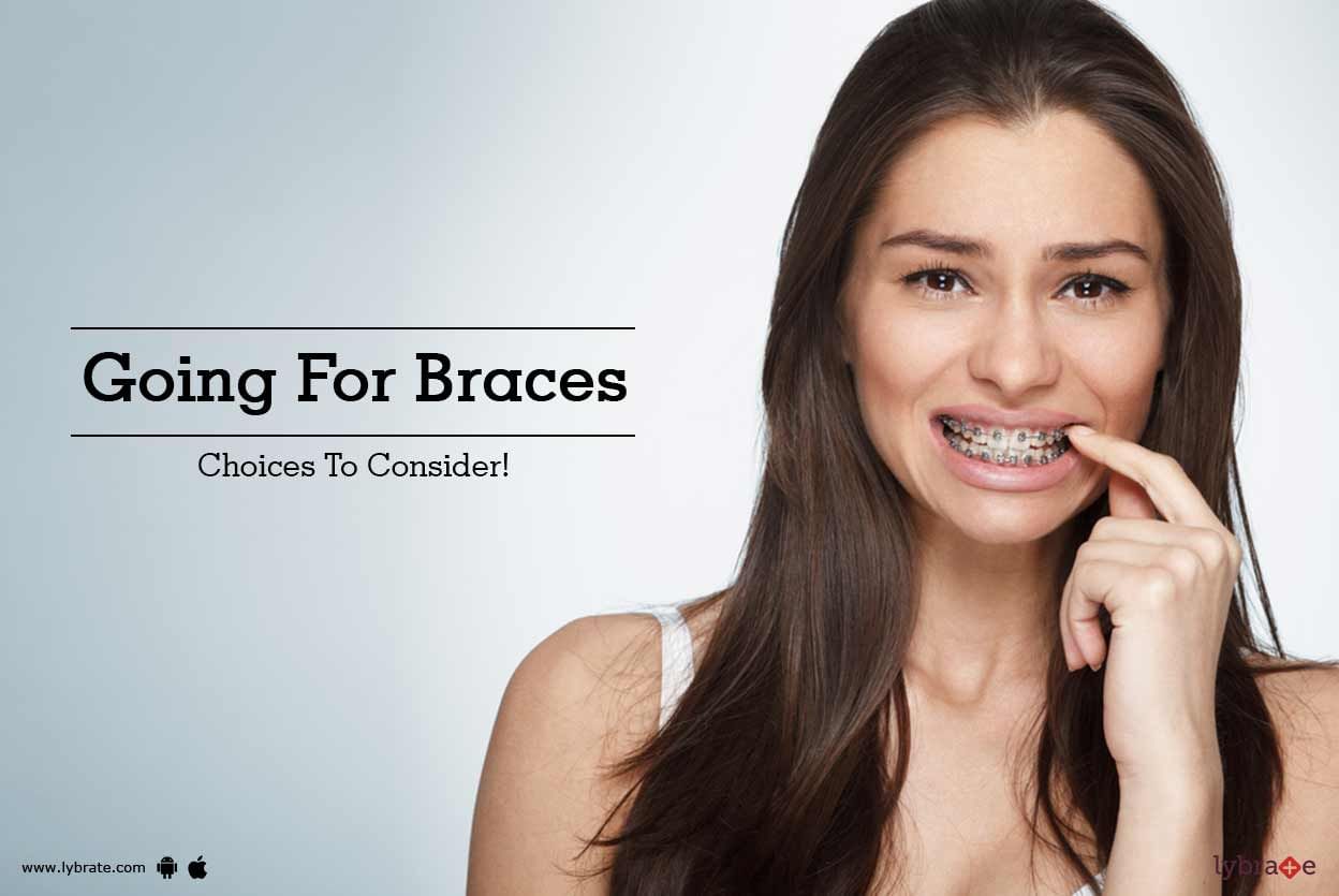 Going For Braces - Choices To Consider!