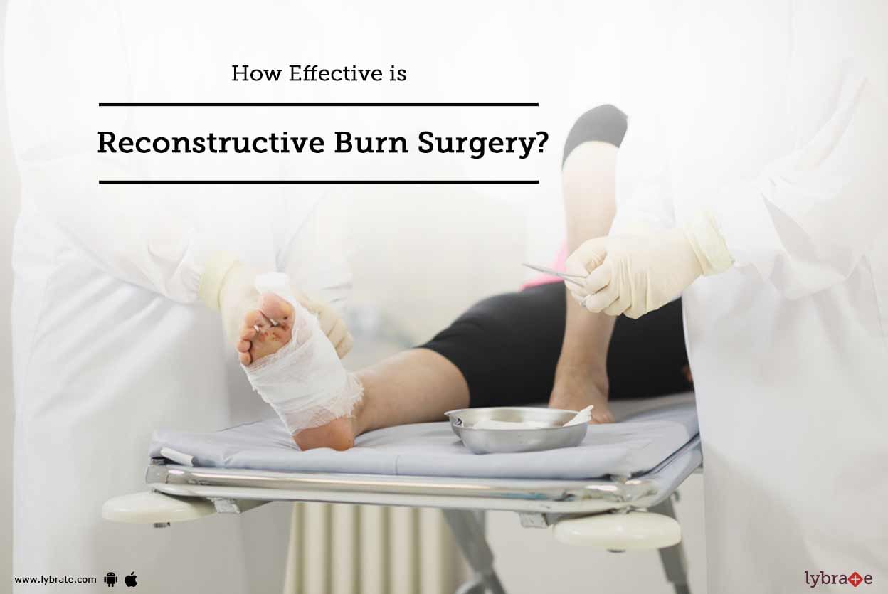 How Effective is Reconstructive Burn Surgery?