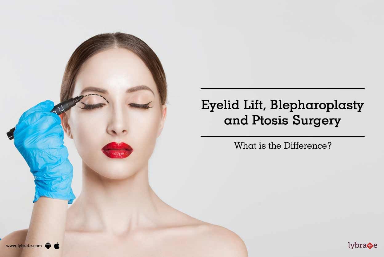 Eyelid Lift, Blepharoplasty and Ptosis Surgery - What is the Difference?