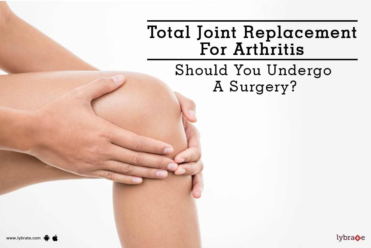 Total Joint Replacement For Arthritis - Should You Undergo A Surgery?