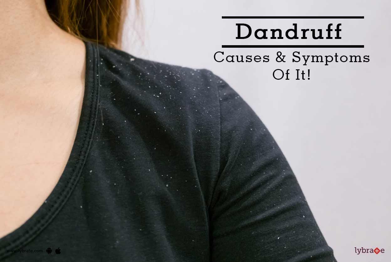 Dandruff - Causes & Symptoms Of It!