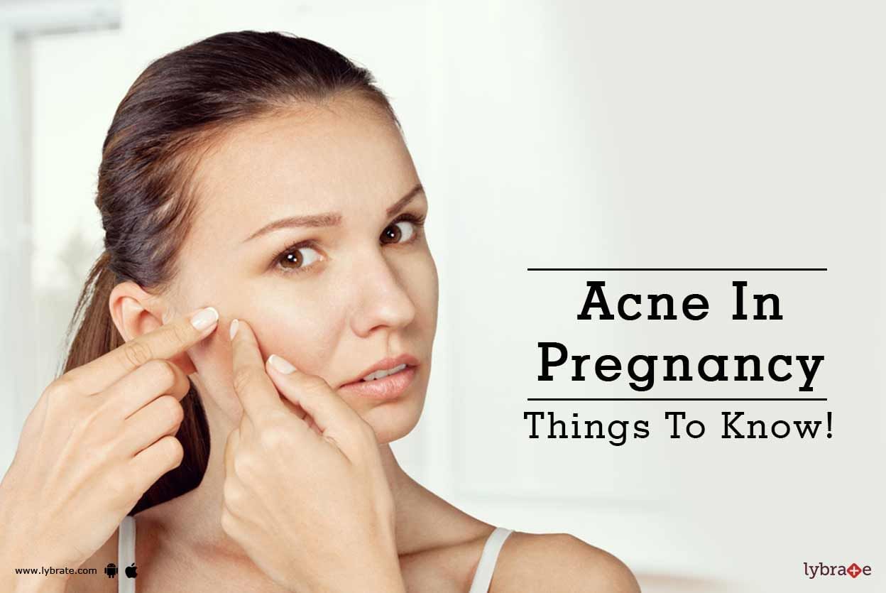 Acne In Pregnancy - Things To Know!