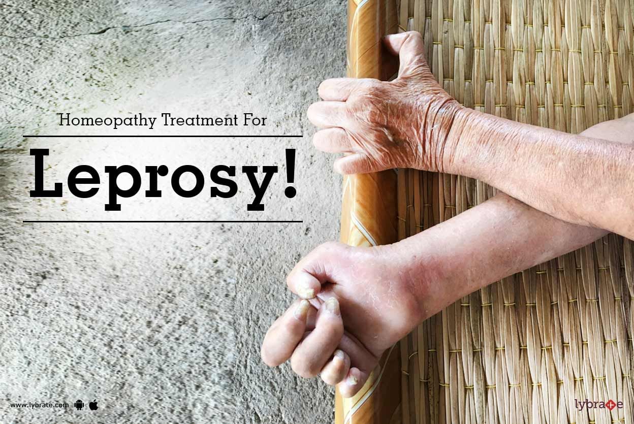 Homeopathy Treatment For Leprosy!