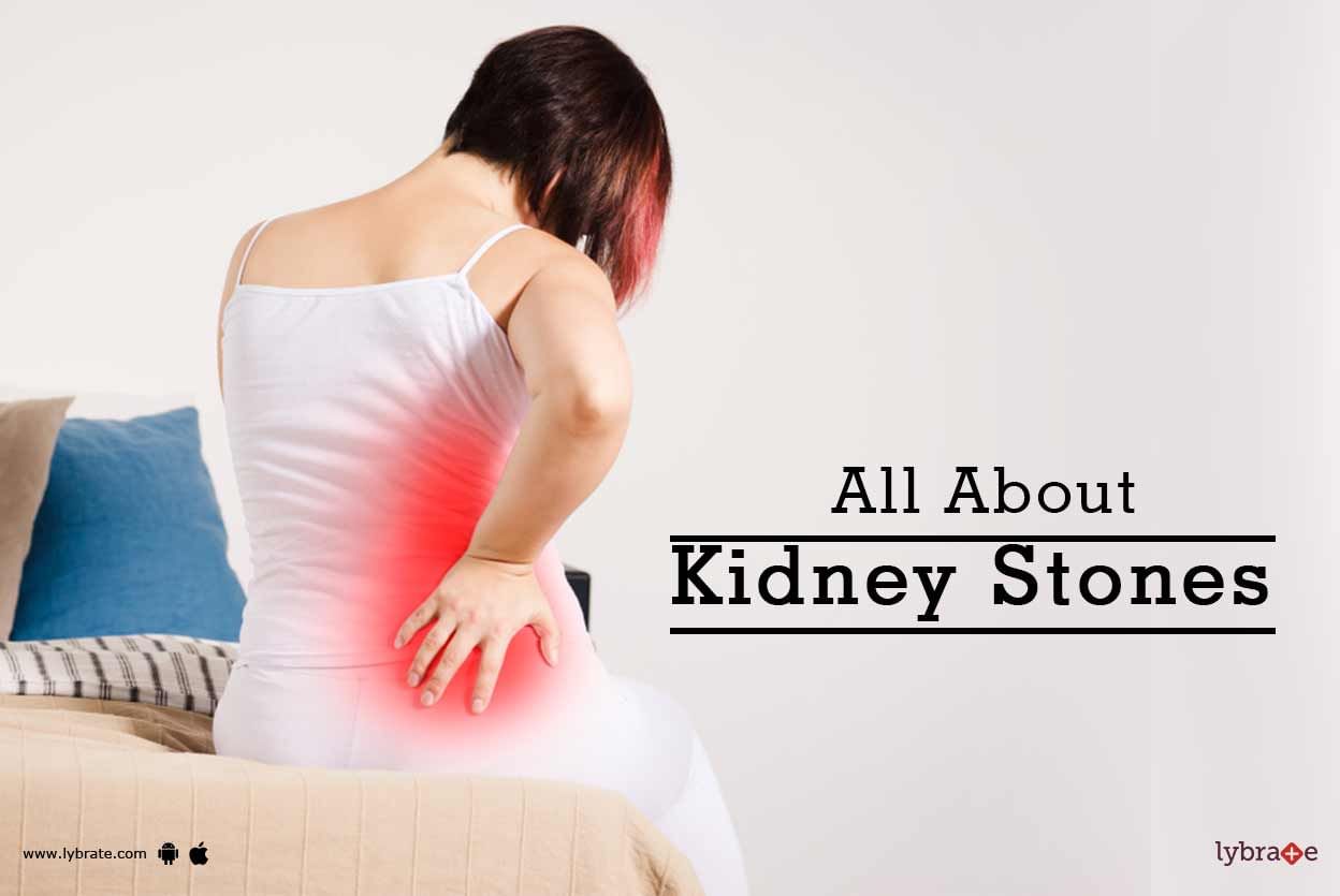 All About Kidney Stones