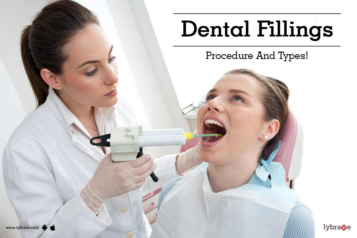 Dental Fillings - Procedure And Types!