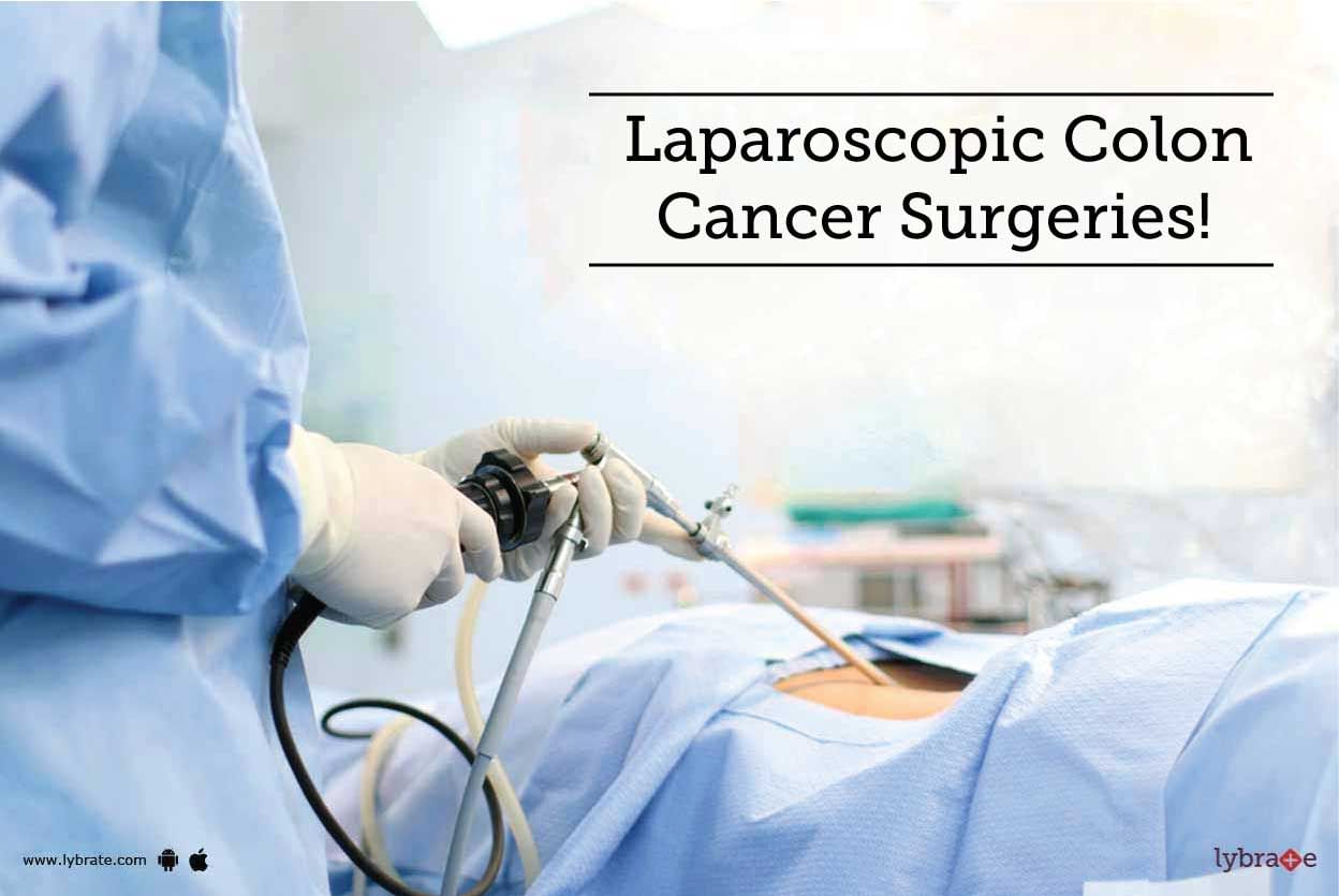 Laparoscopic Colon Cancer Surgeries!