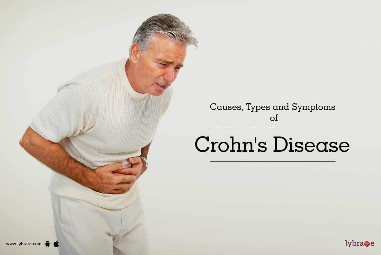 Causes, Types and Symptoms of Crohn's disease
