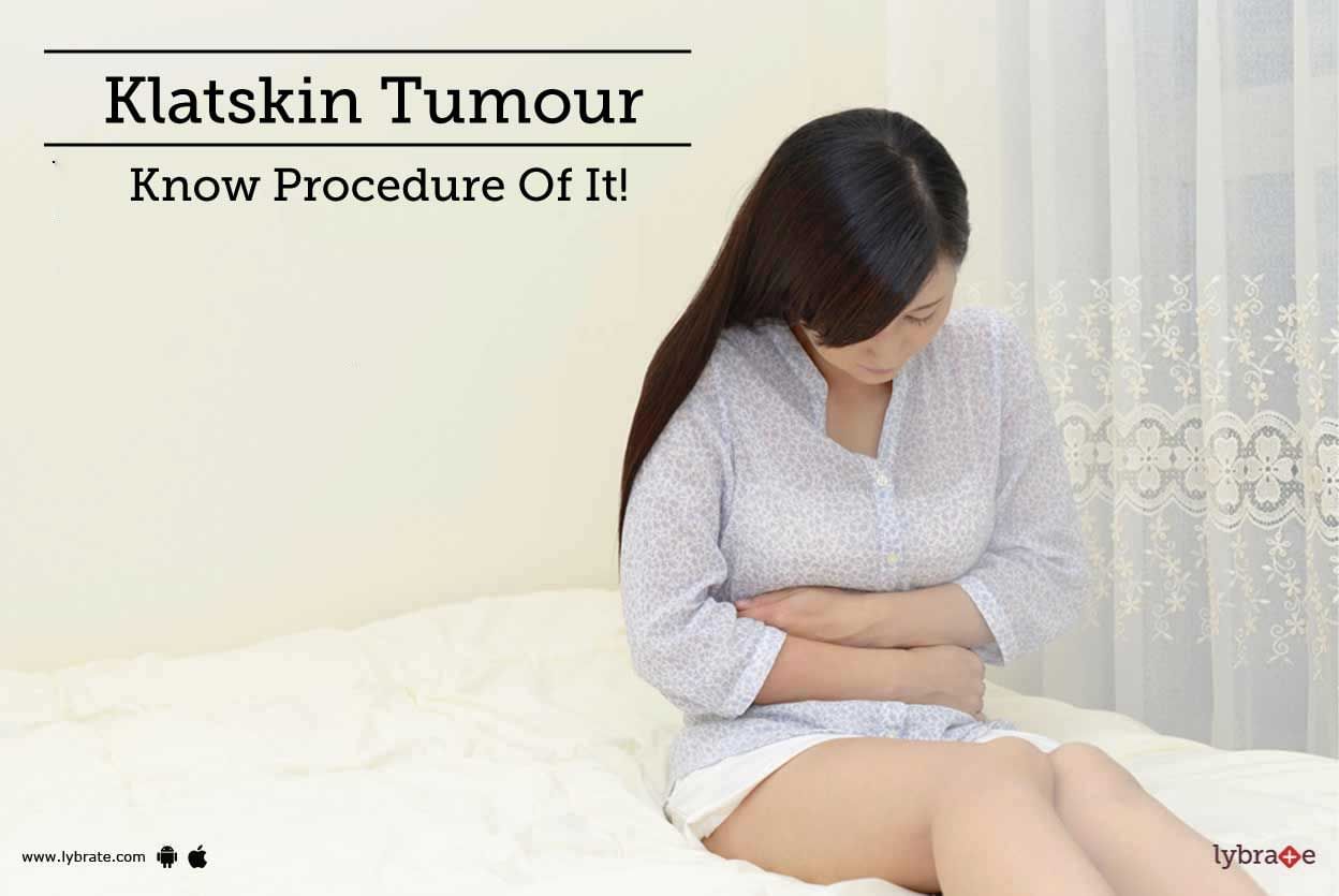 Klatskin Tumour - Know Procedure Of It!