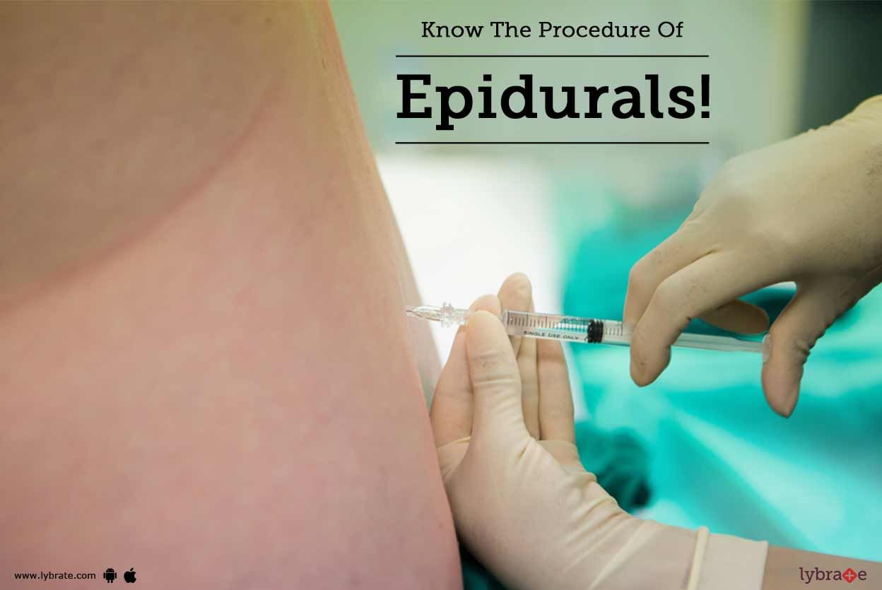 Know The Procedure Of Epidurals!