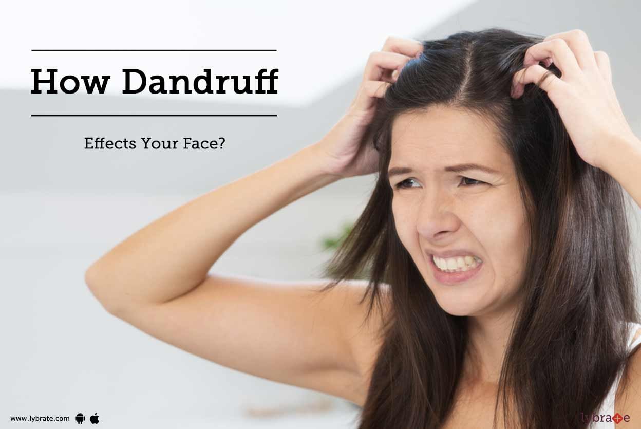 How Dandruff Effects Your Face?