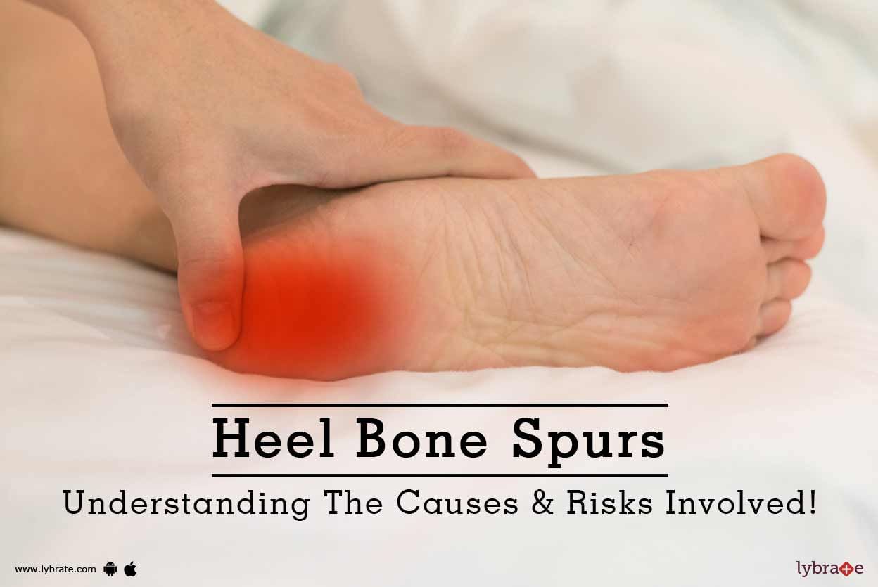 Heel Bone Spurs - Understanding The Causes & Risks Involved!