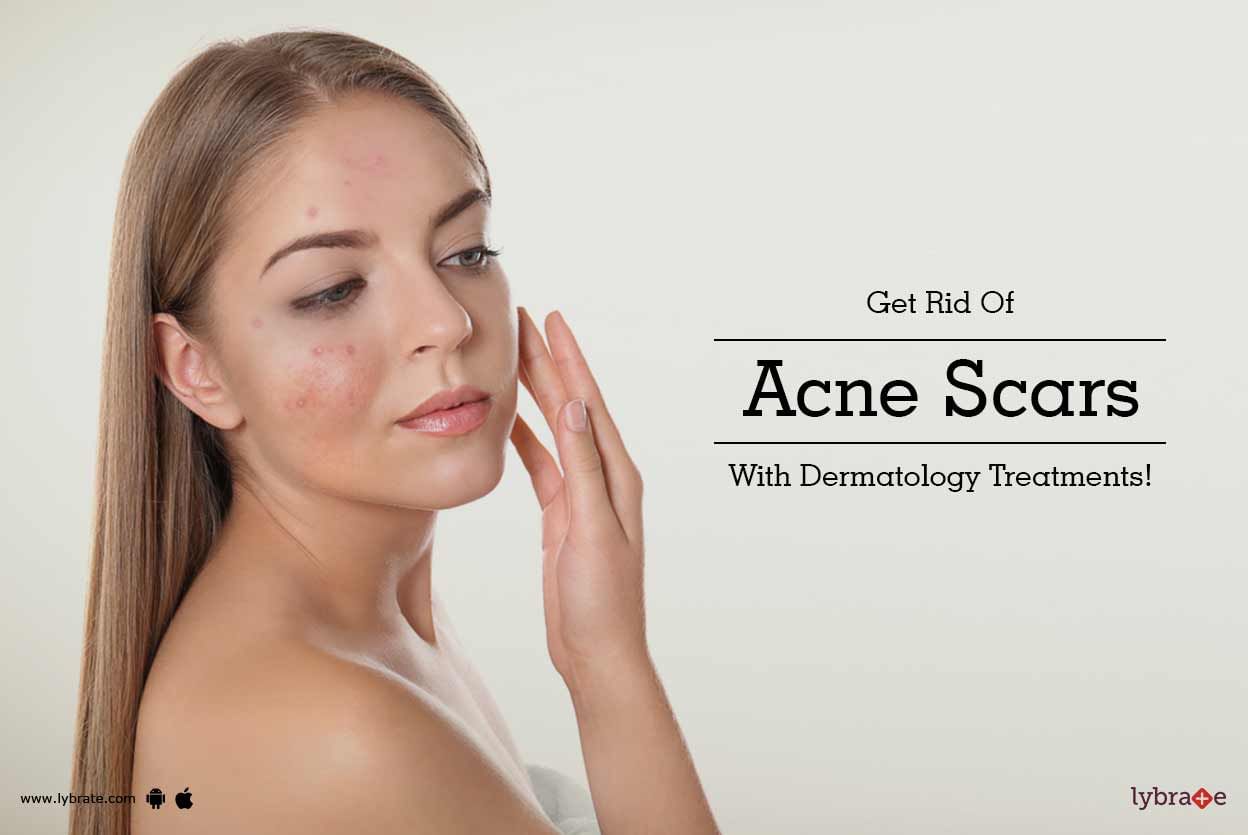 Get Rid Of Acne Scars With Dermatology Treatments!