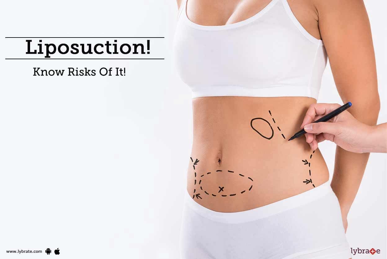 Liposuction - Know Risks Of It!
