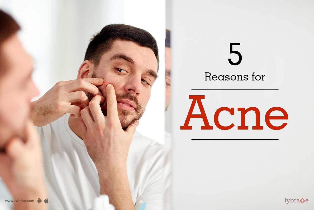 5 Reasons for Acne