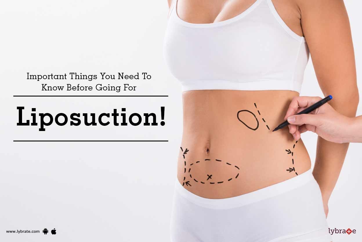 Important Things You Need To Know Before Going For Liposuction!