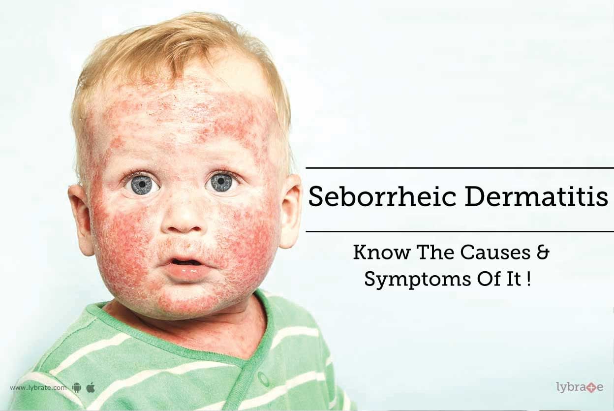 Seborrheic Dermatitis - Know The Causes & Symptoms Of It!