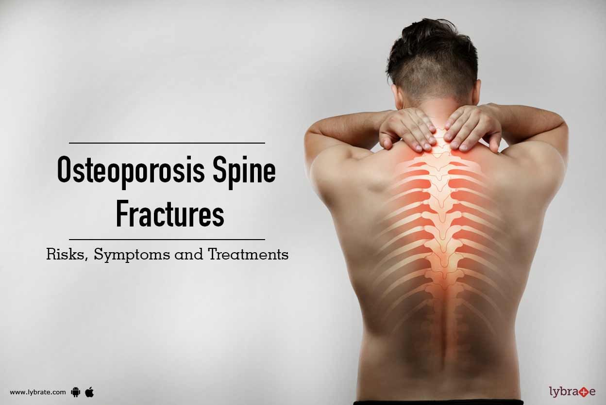 Osteoporosis Spine Fractures: Risks, Symptoms and Treatments