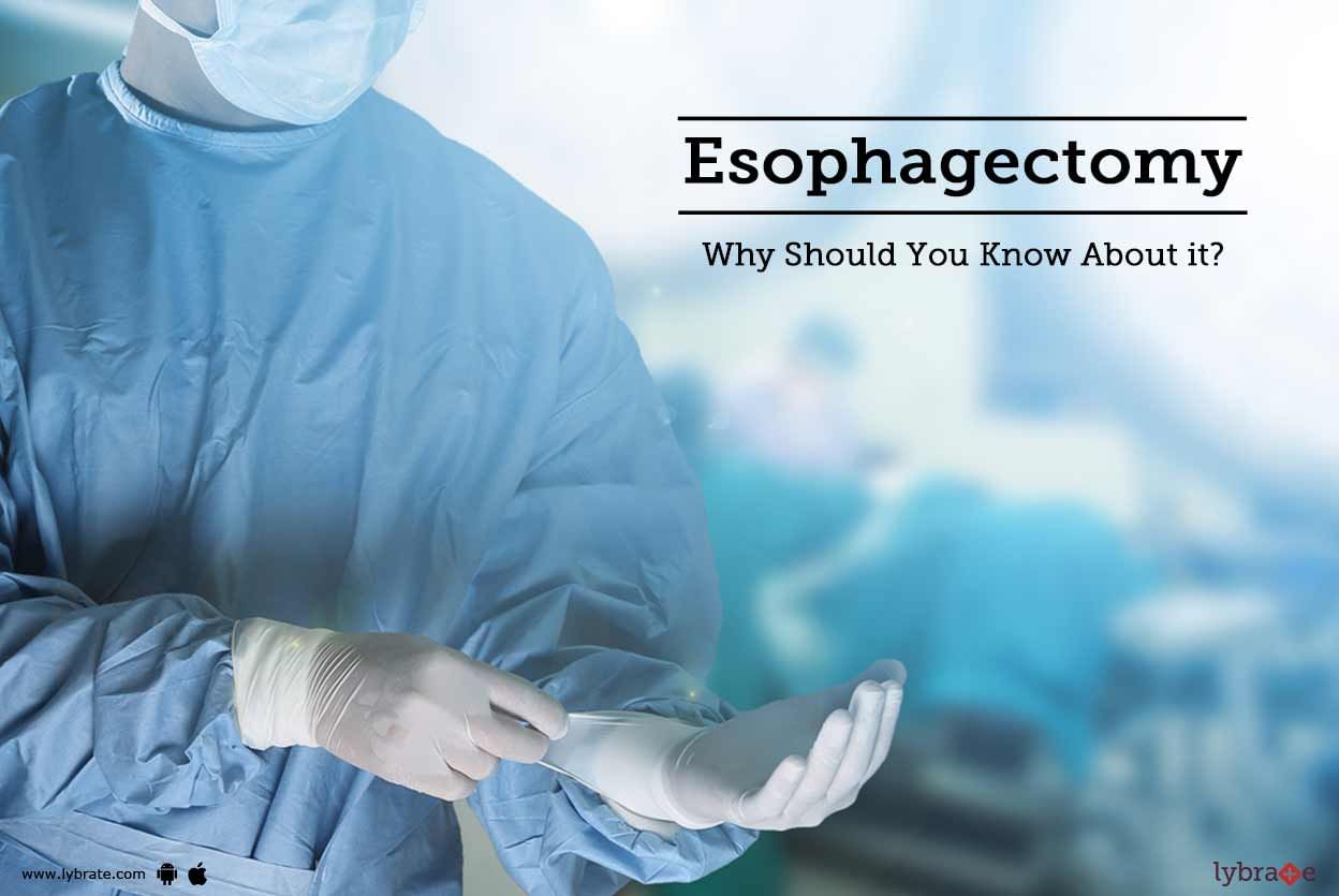 Esophagectomy - Why Should You Know About it?