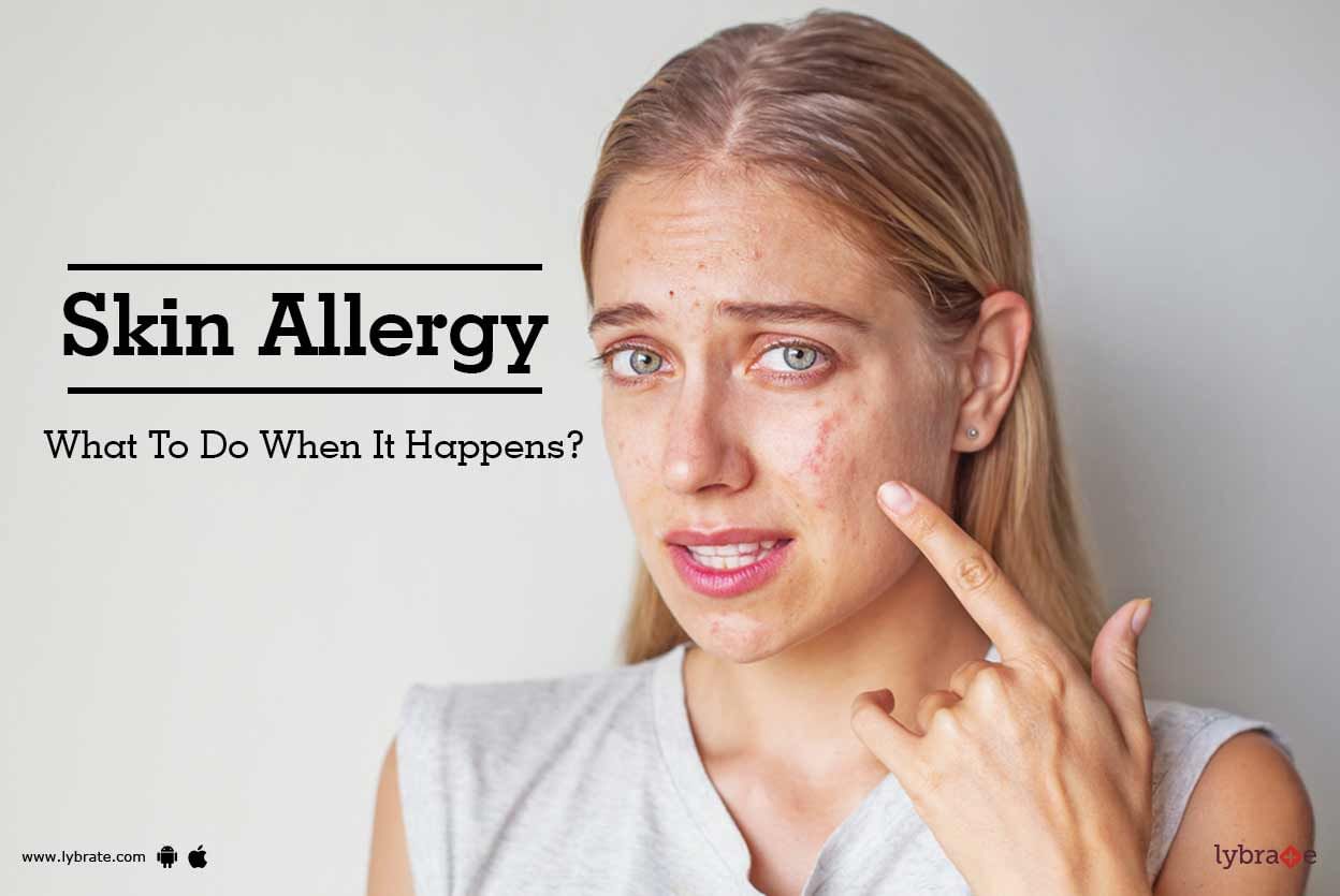 Skin Allergy - What To Do When It Happens?