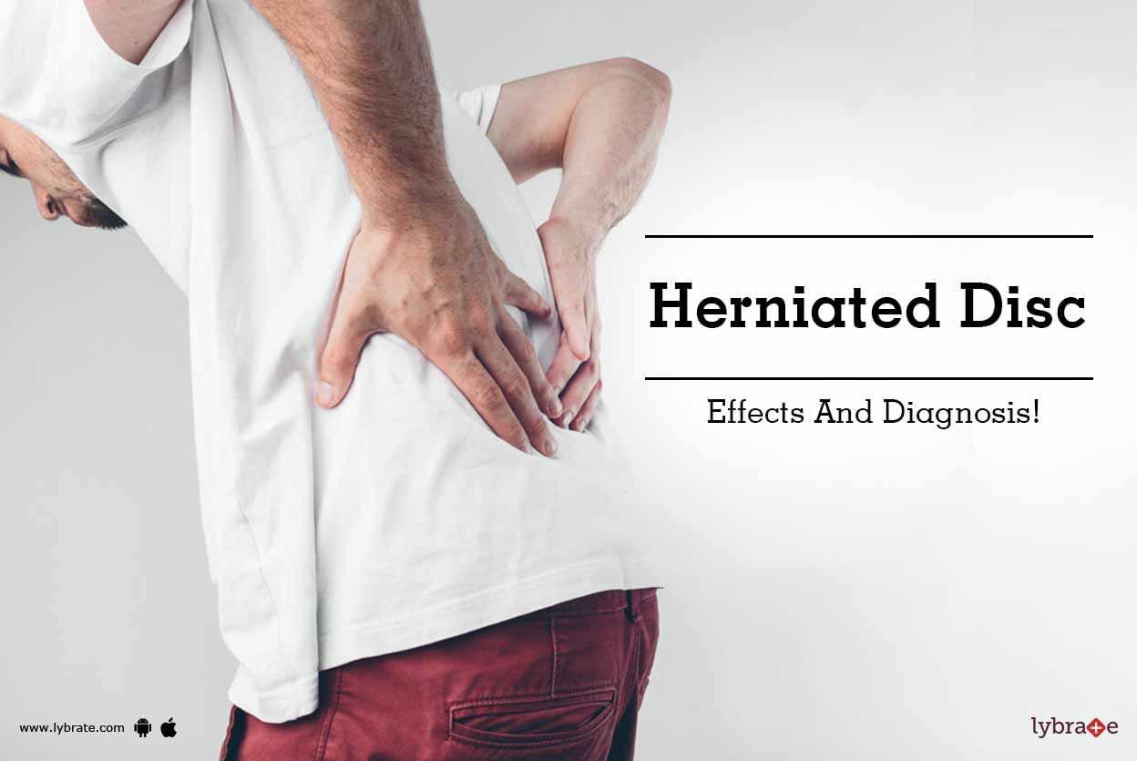 Herniated Disc - Effects And Diagnosis!