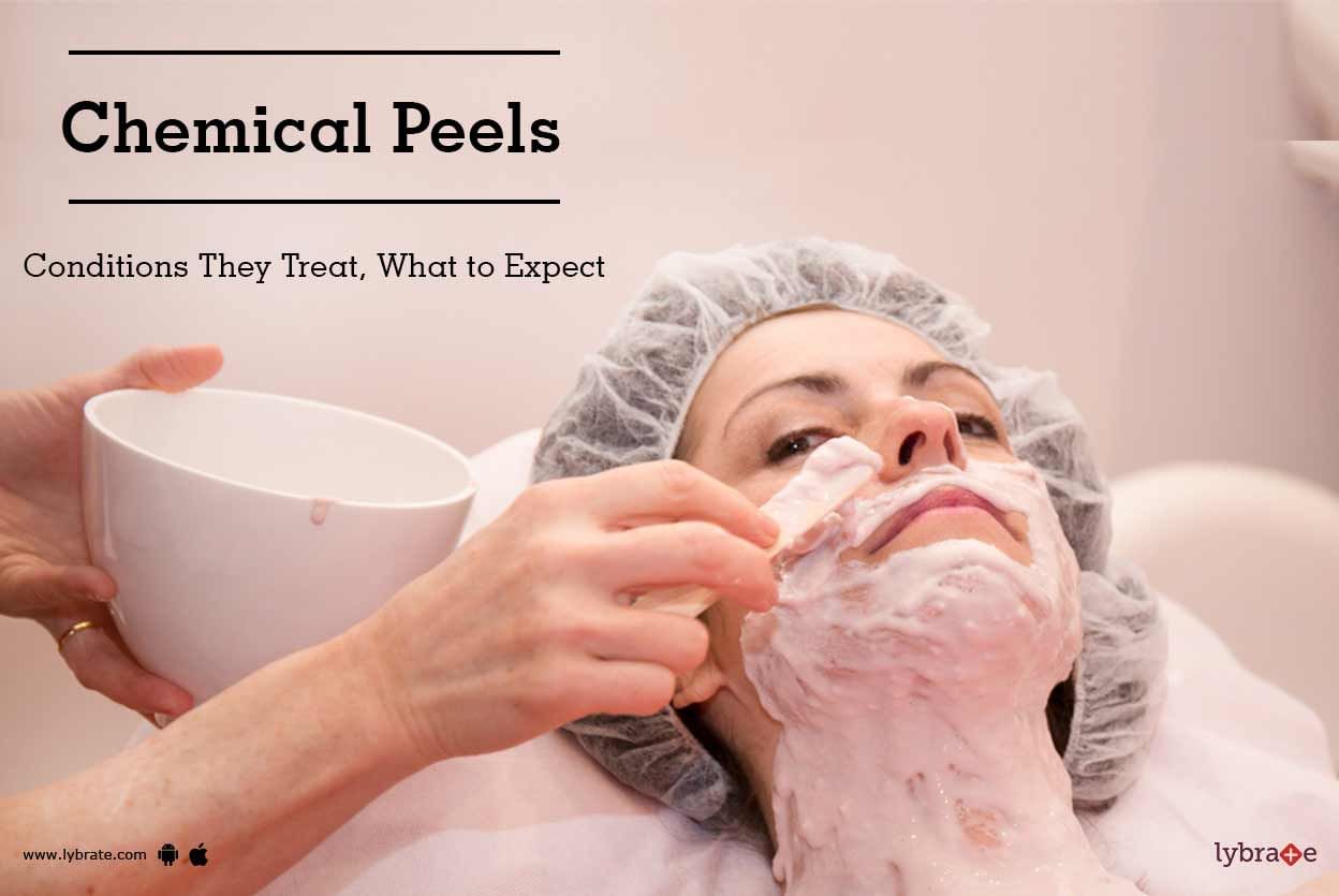 Chemical Peels: Conditions They Treat, What to Expect
