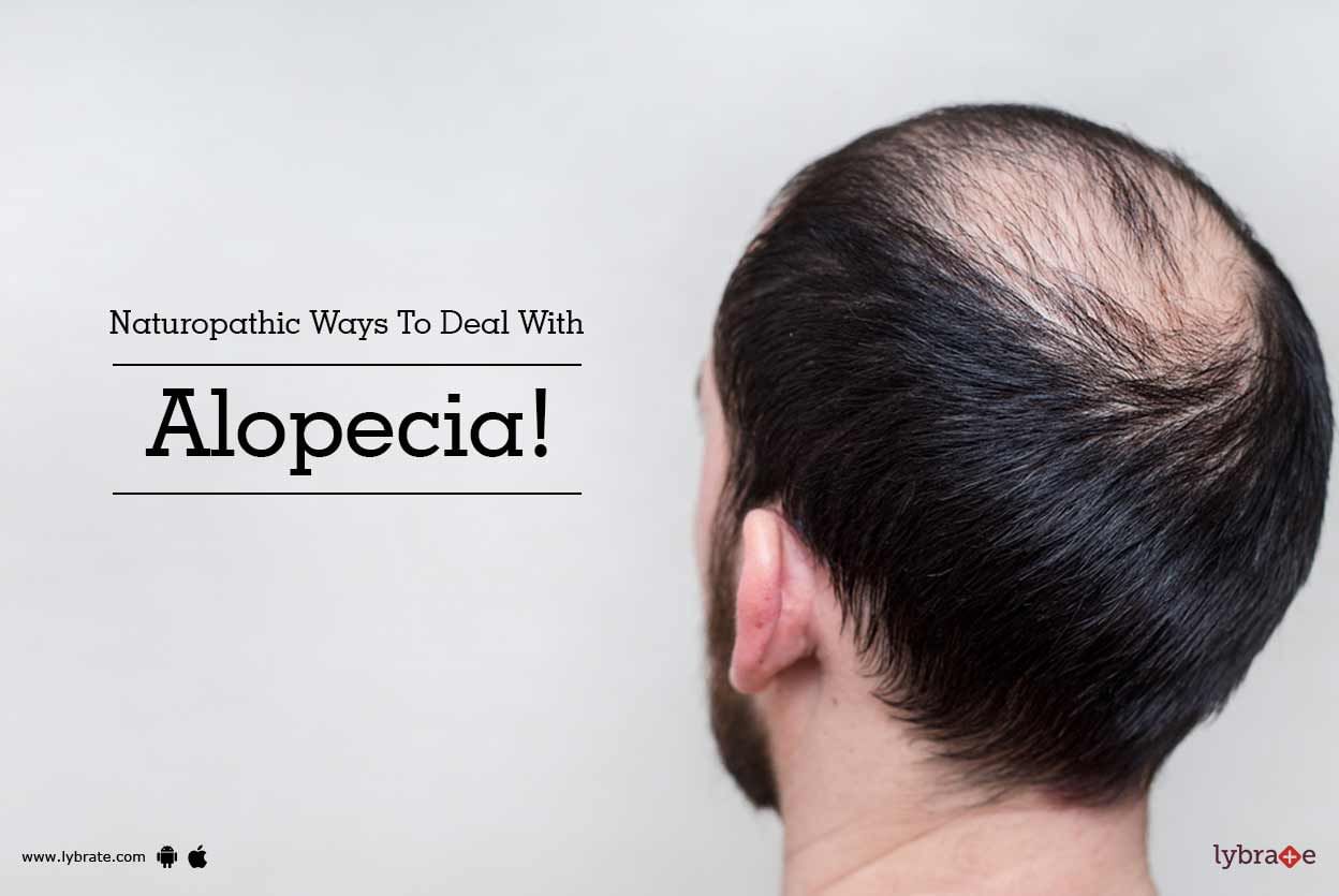 Naturopathic Ways To Deal With Alopecia!