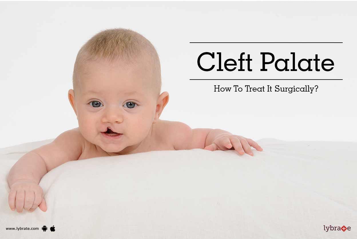 Cleft Palate - How To Treat It Surgically?