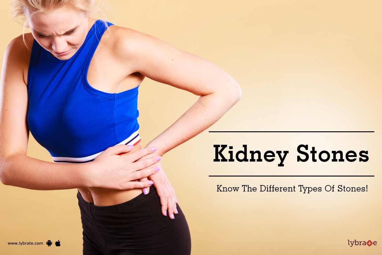 Kidney Stones - Know The Different Types Of Stones!