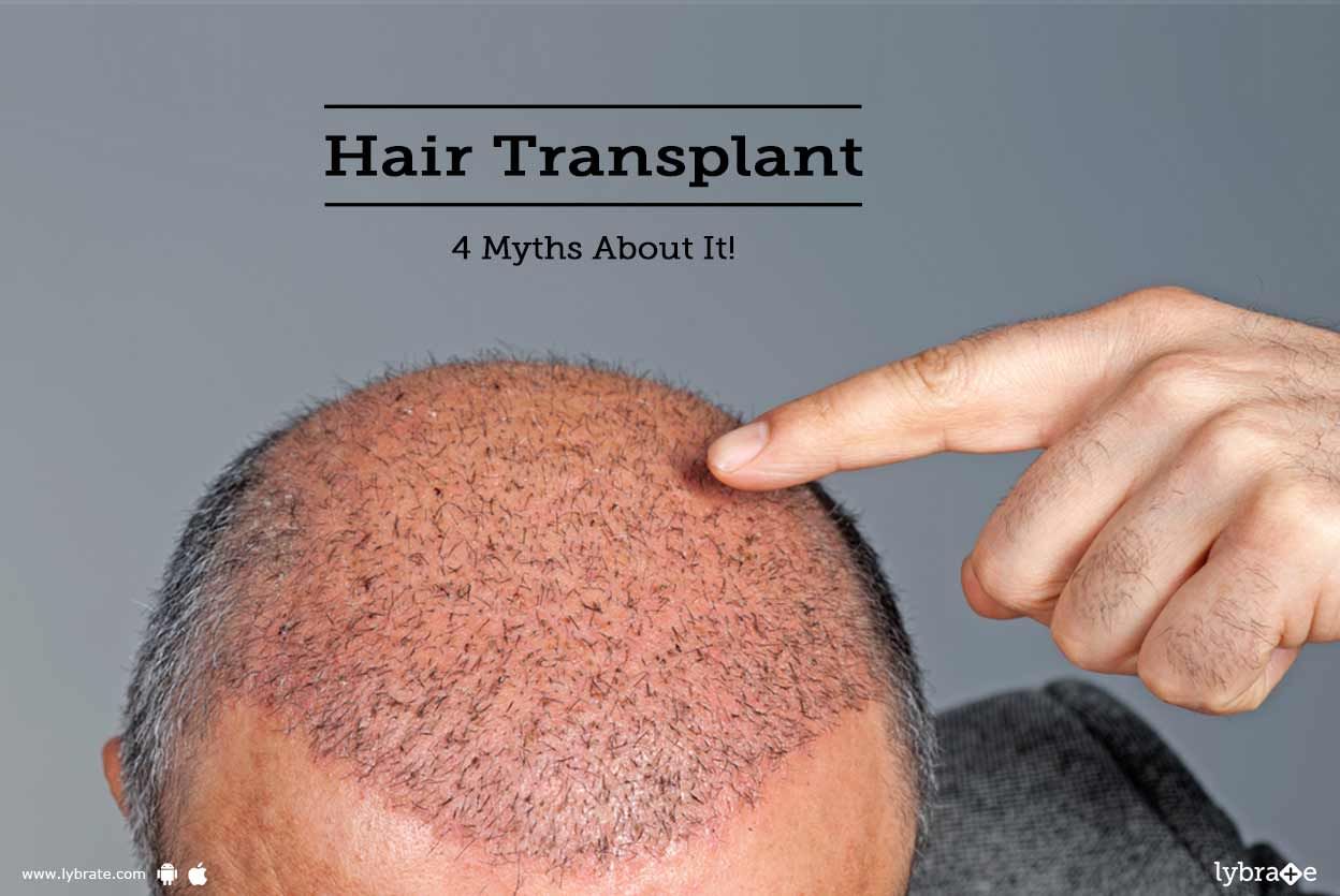 Hair Transplant - 4 Myths About It!