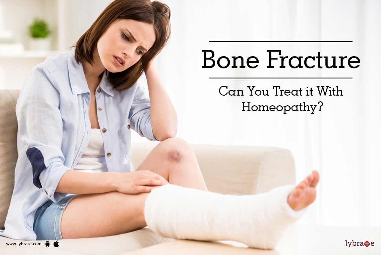 5 Best Homeopathic Medicine for Bone Fracture Treatment