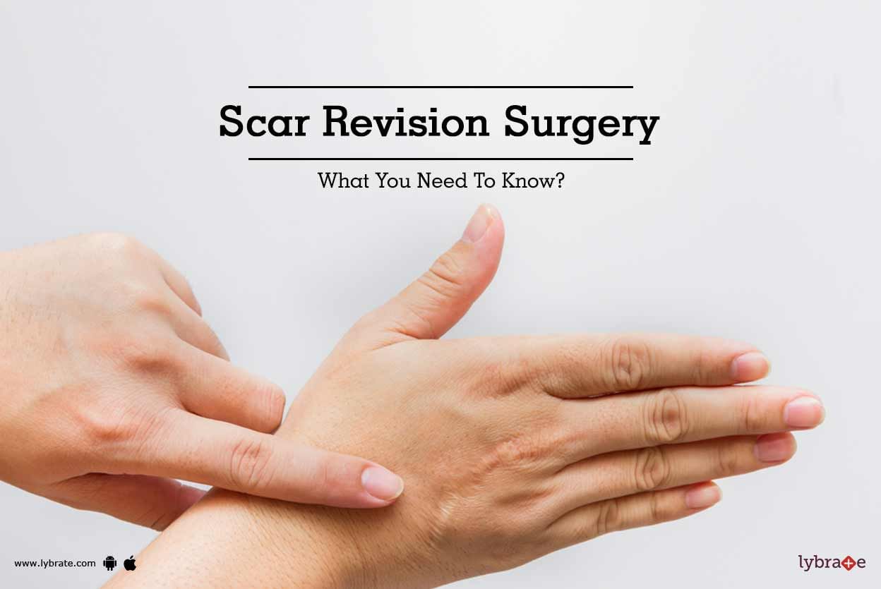 Scar Revision Surgery: What You Need To Know?