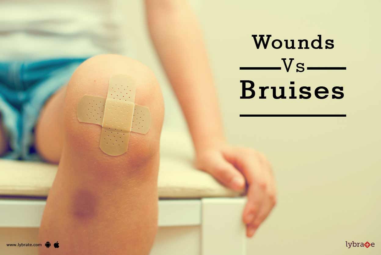 Wounds Vs Bruises