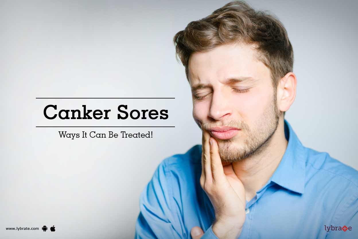 Canker Sores - Ways It Can Be Treated!