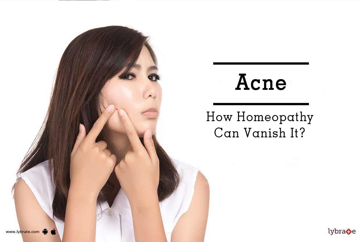 Acne - How Homeopathy Can Vanish It?