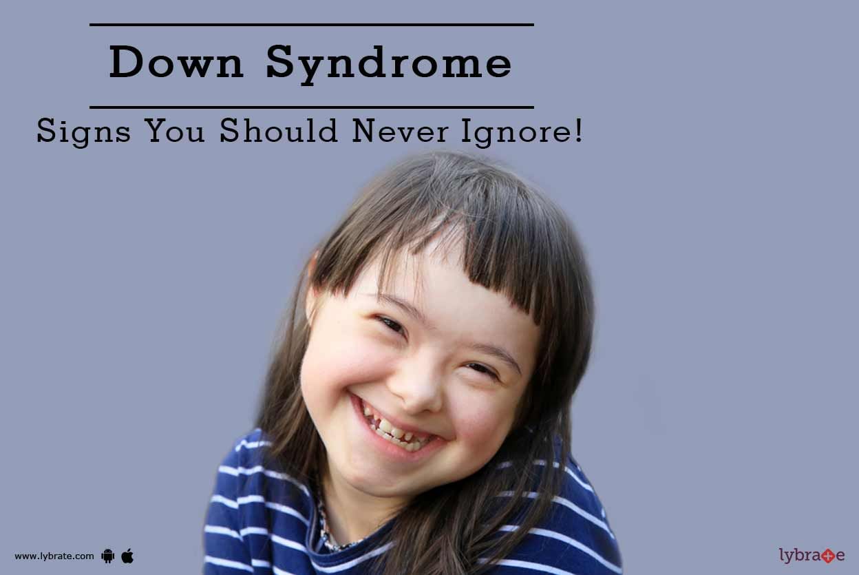 Down Syndrome - Signs You Should Never Ignore!