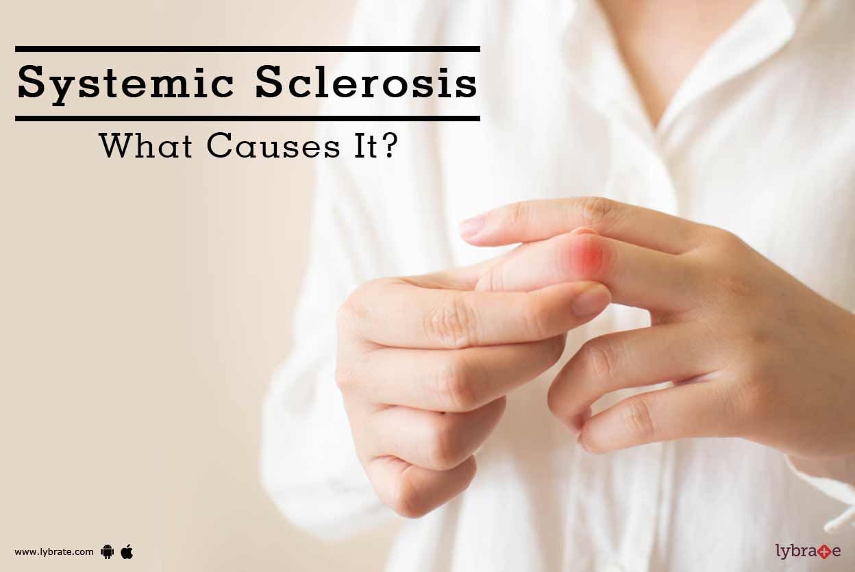 Systemic Sclerosis - What Causes It?