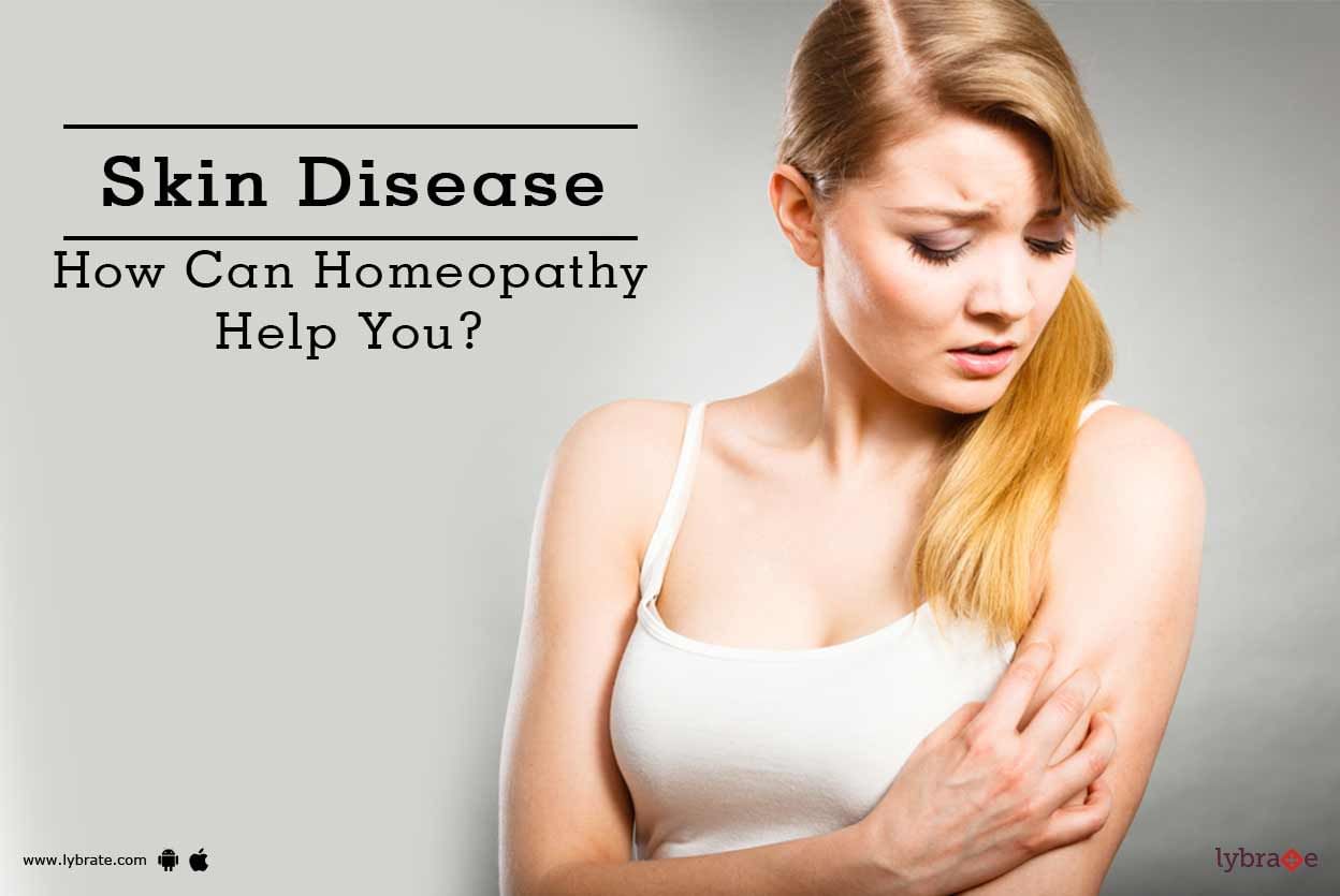 Skin Disease - How Can Homeopathy Help You?