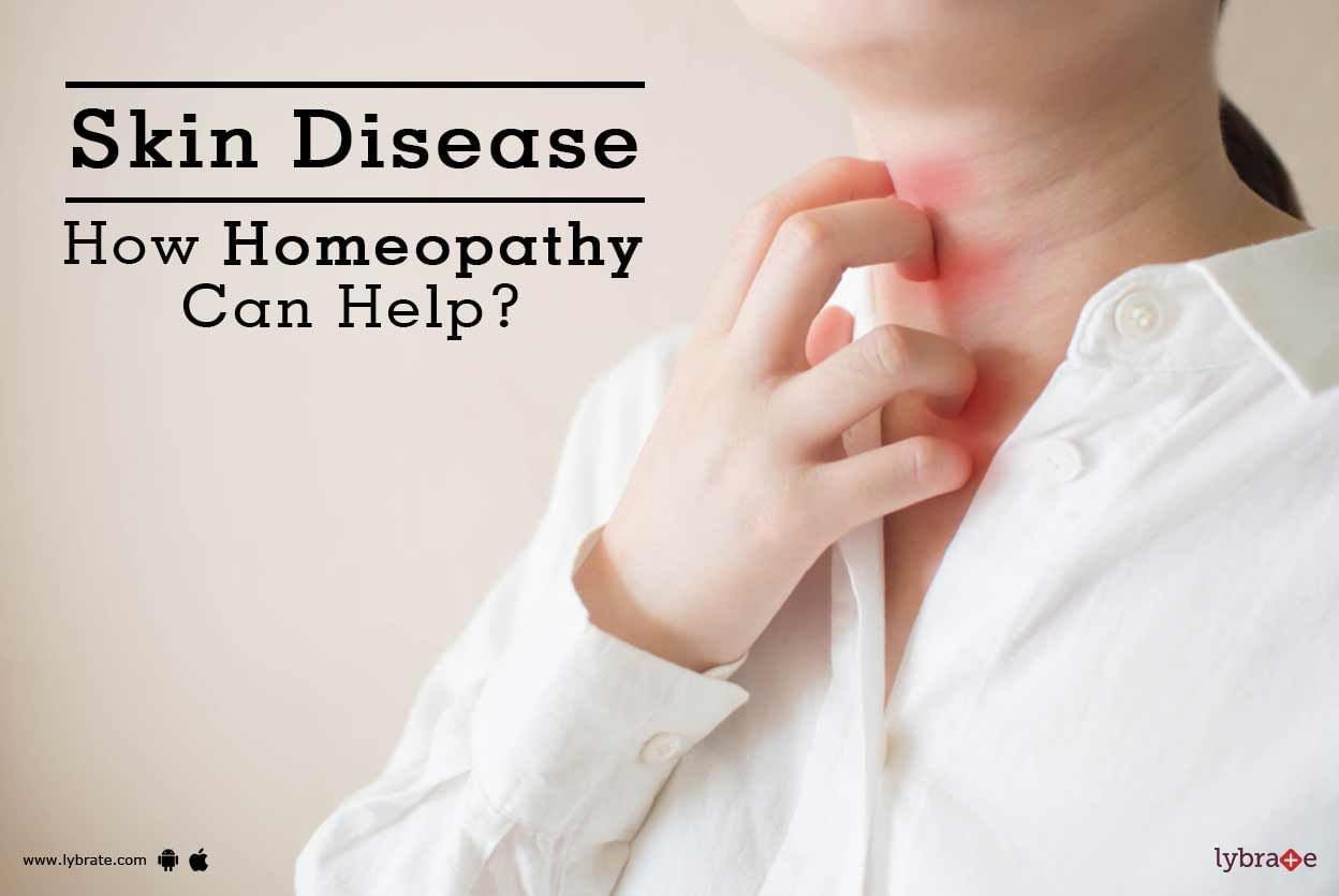 Skin Disease - How Homeopathy Can Help?