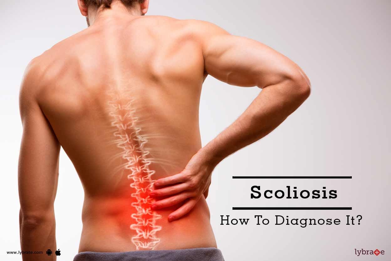 Scoliosis - How To Diagnose It?