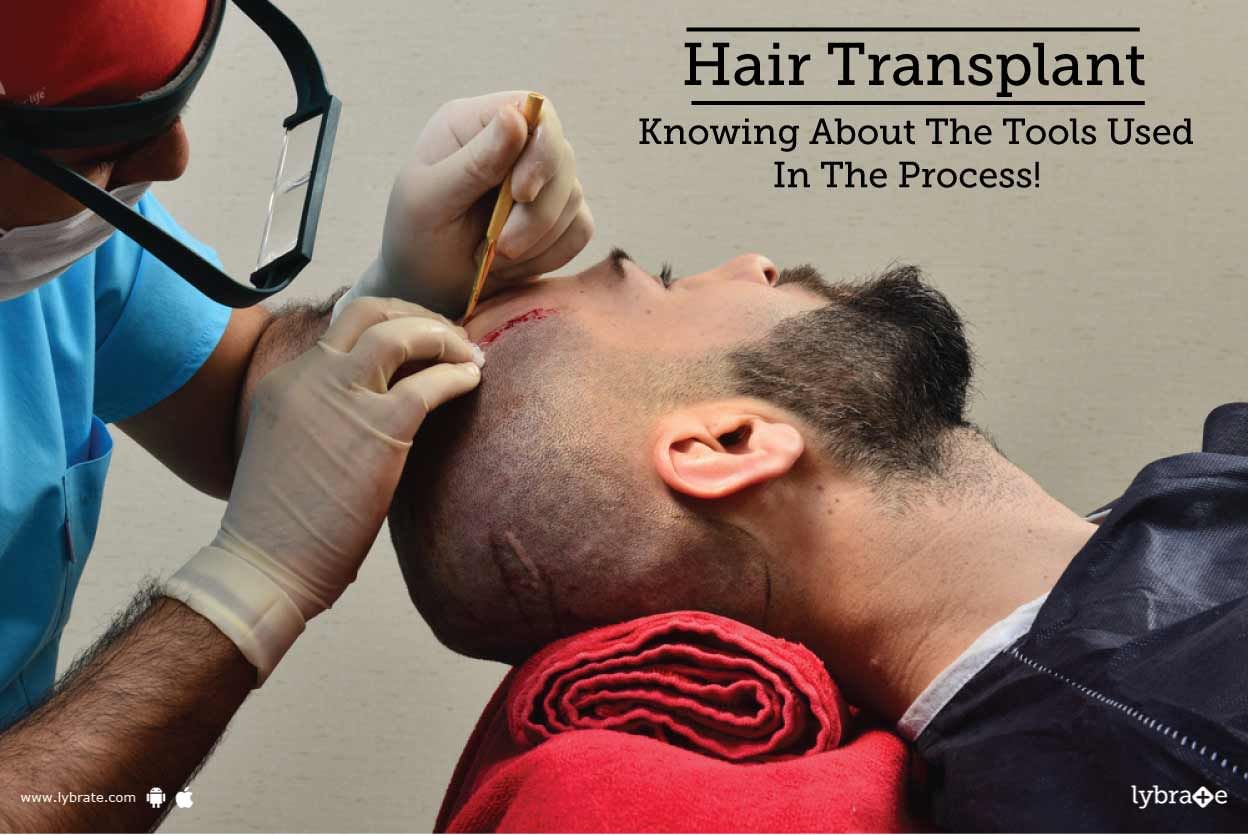 Hair Transplant - Knowing About The Tools Used In The Process!