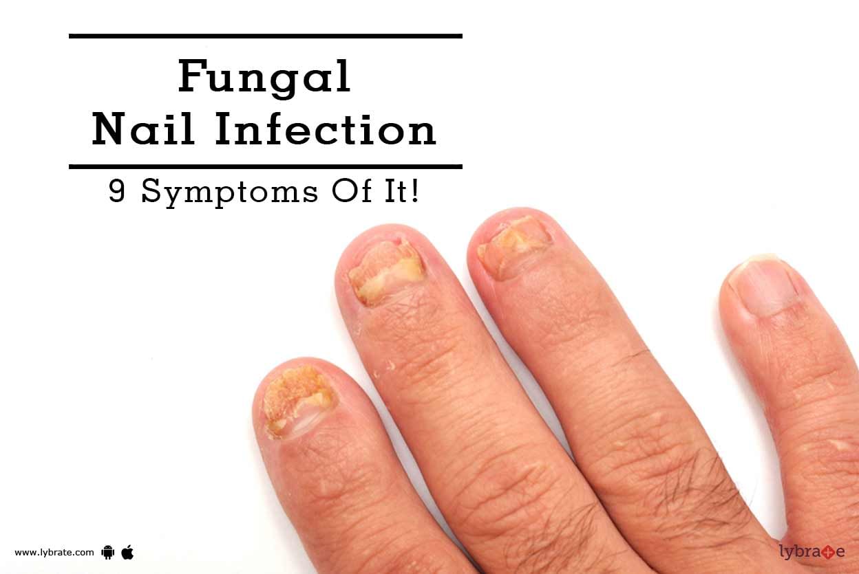 Fungal Nail Infection - 9 Symptoms Of It!