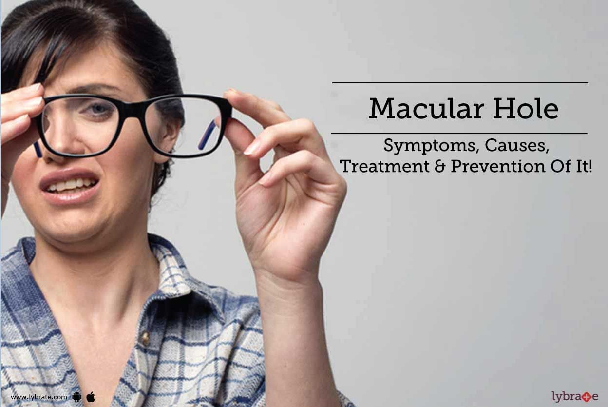 Macular Hole - Symptoms, Causes, Treatment & Prevention Of It!