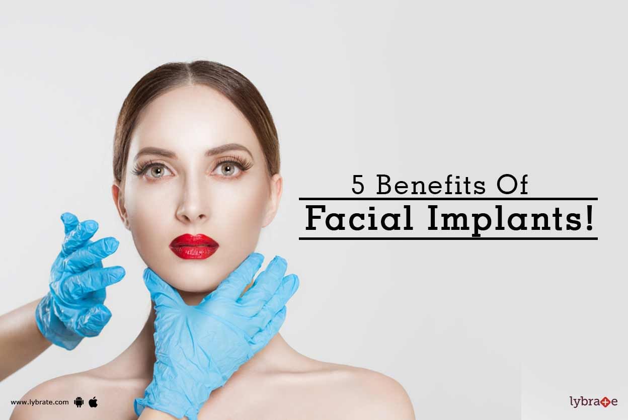 5 Benefits Of Facial Implants!