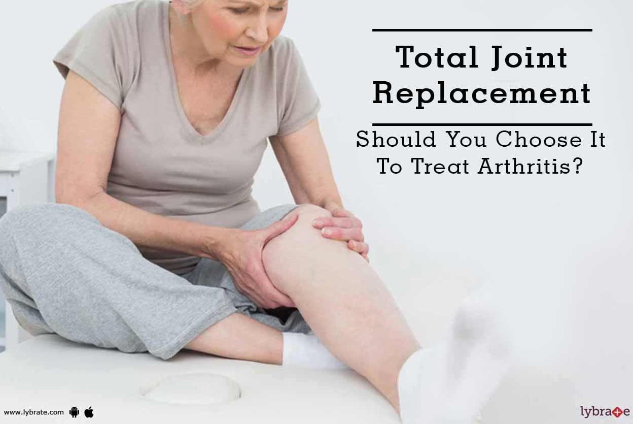 Total Joint Replacement - Should You Choose It To Treat Arthritis?