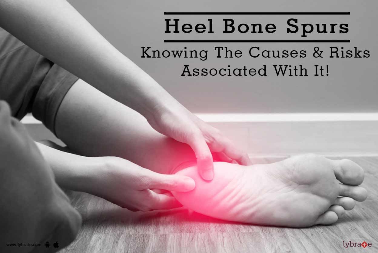 Heel Bone Spurs - Knowing The Causes & Risks Associated With It!