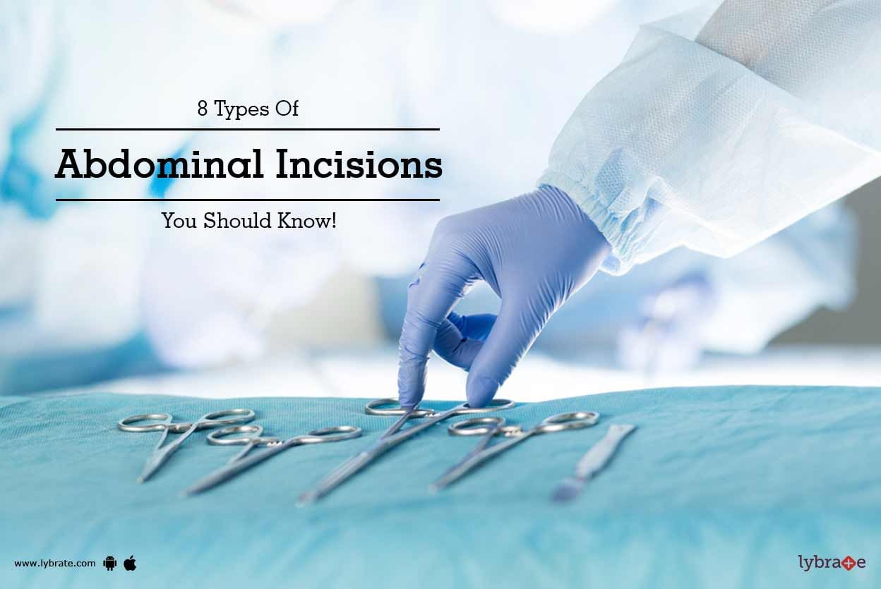8 Types Of Abdominal Incisions You Should Know!