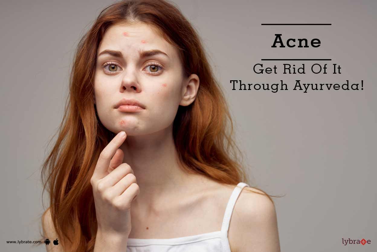 Acne - Get Rid Of It Through Ayurveda!
