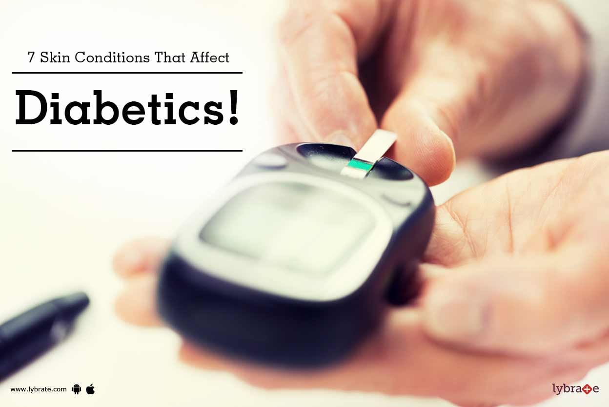 7 Skin Conditions That Affect Diabetics!