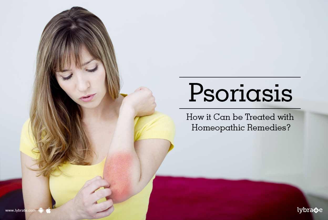 Psoriasis - How it Can be Treated with Homeopathic Remedies?