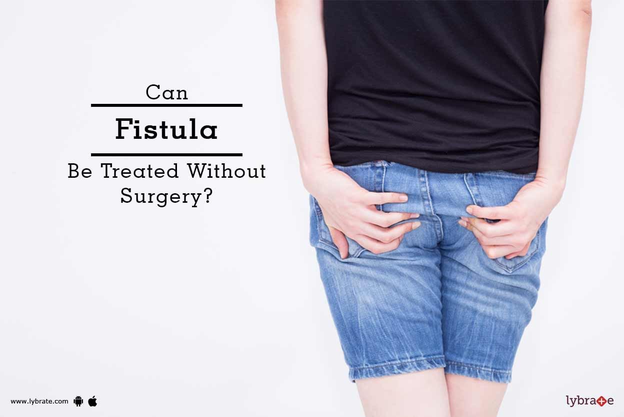 Can Fistula Be Treated Without Surgery?